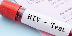VIH SIDA 2